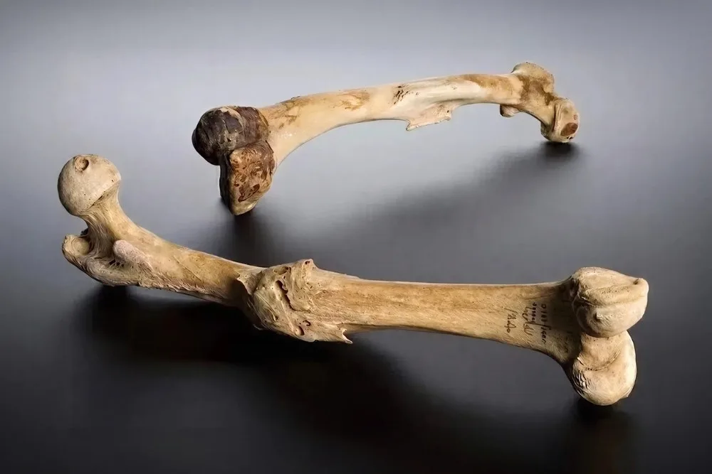 El primer signo de civilización. Historia de un fémur roto que sanó.